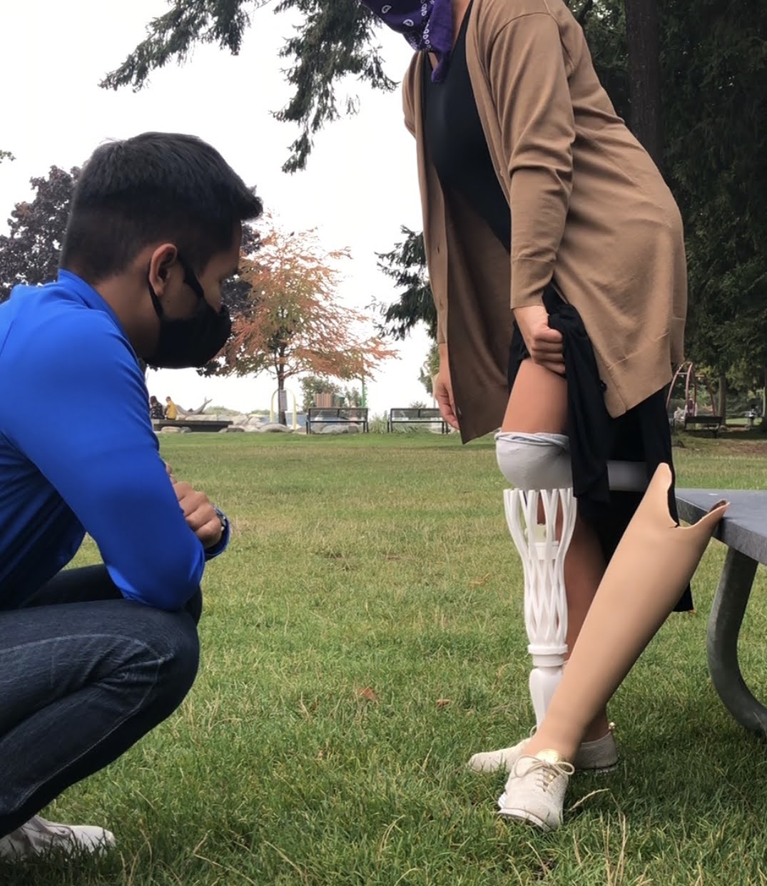Prosthetic pointe shoe patient